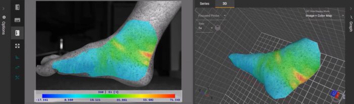 DefleX®-3D DIC area skin tissue example. Full-field strain analysis teaching tool. From theory to reality - Seeing in microscopic detail